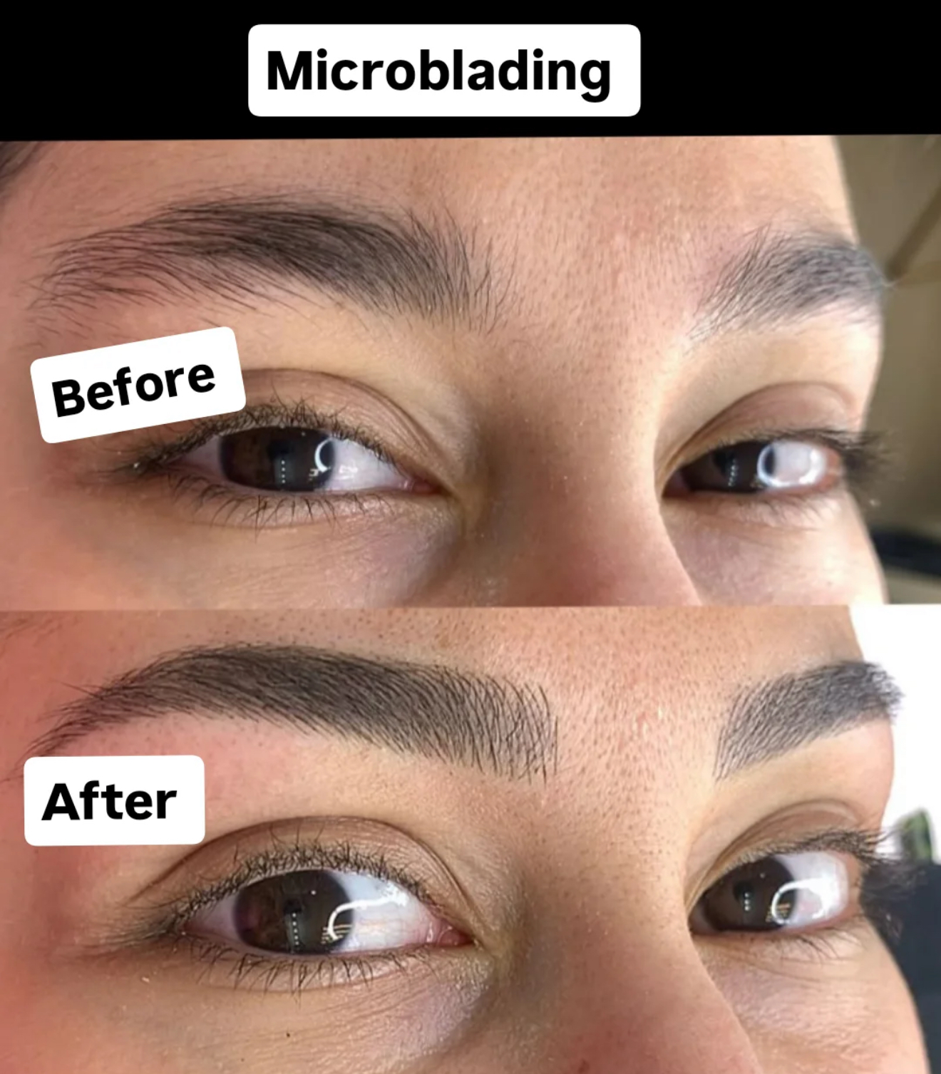 Microblading